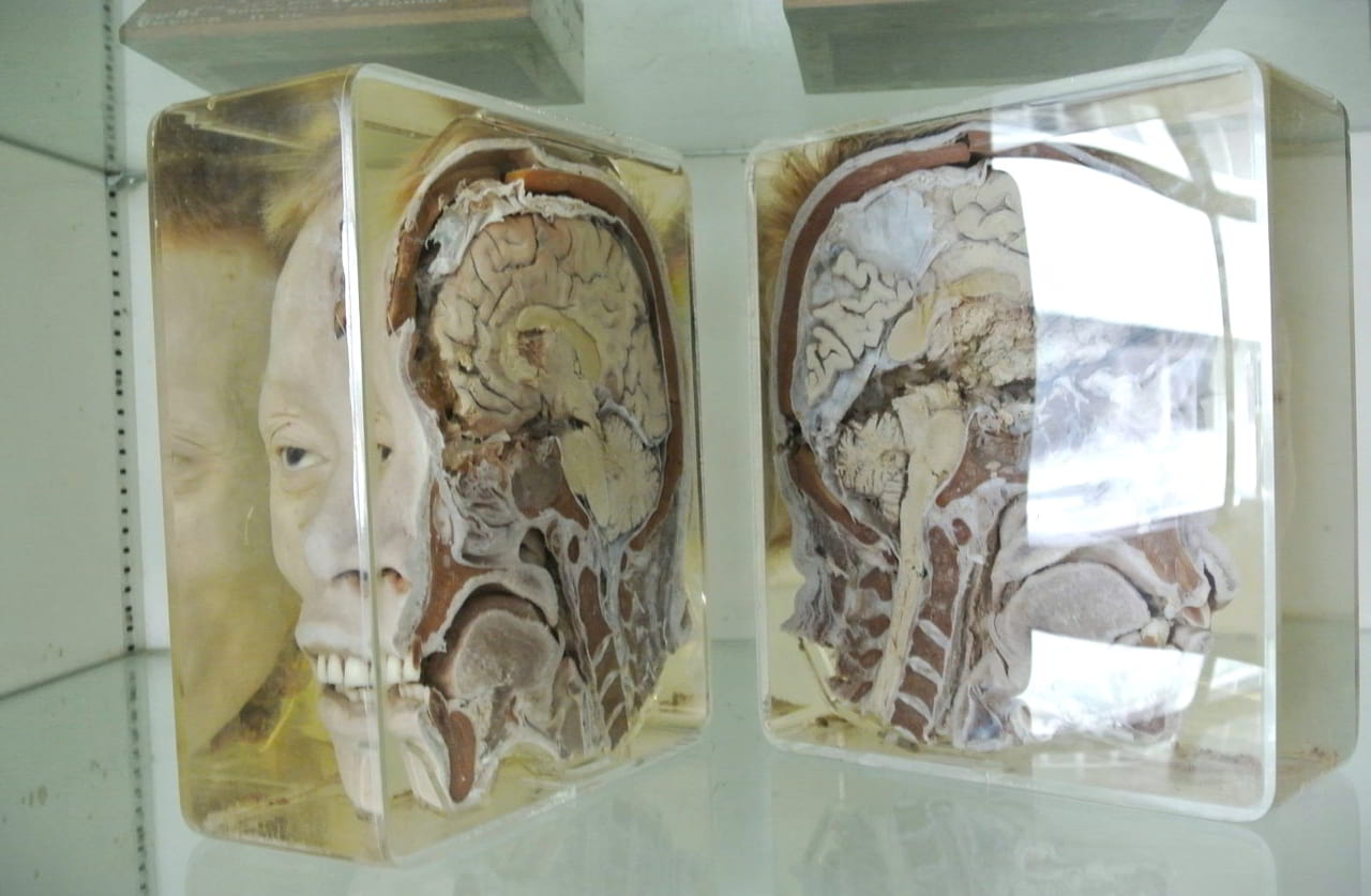 Discover the Siriraj Museum: A Journey Through Medical Curiosities